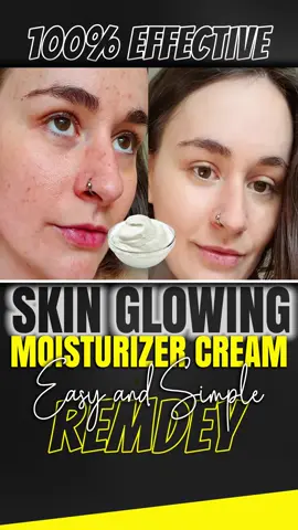 Skin Glowing Moisturising Cream | Moisturize your skin at home - Best Moisturizer for Glowing Skin. Simple and Easy Remdey at Home #moisturizer #skinglowing #glowskincare #glowskinenhancement #skinmoisturizer #moisturizerviral #moisturizercream #moisturizerskintific #trending #foryou #fyp #foryoupage 
