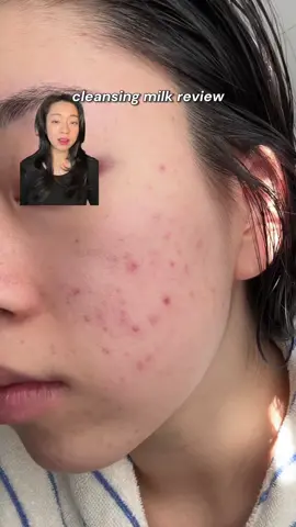 Cleansing milk review!! @dewytree_official hi amino all cleansing milk #bioturm #cleansingmilk 