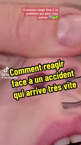 Geste qui peut vous évitez bien des problèmes ! Fonctionne environ 8fois sur 10. ℹ️⚠️✅👉 #just_papa #pourtoi #infobebe #monbebe #bebe #bienveillance #parentalite #bebe2023 #bebe2023 #bebe2024 #grossesse2023 #grossesse #grossesse2024 #capricesbebe #maternite #jeunesparents #parentalitepositive #parentalitebienveillante #devenirmaman #devenirmeilleur #devenirpapa #devenirparent #papa #maman #parents #secourisme #gestesetsoinsdurgences #soignerbebe #commentfaire #accidentbebe #jumeaux #conseil #conseilpapa #astuce #astucepapa #accouchement #accouchement2023 #accouchement2024 #futurmaman #futurpapa #futurparents #bientotpapa #bientotmaman #bientotparents #bebearrive #prevention #sauverdesvies 