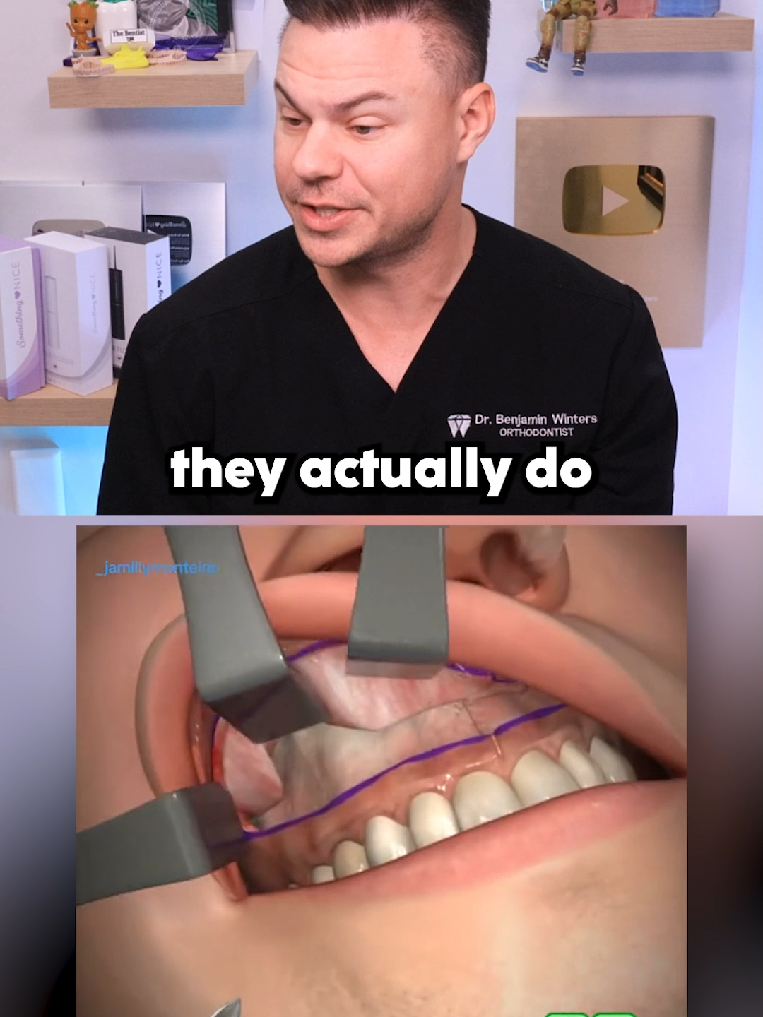 Dentist Reveals What REALLY Happens In Facial Surgery! #surgery #teeth #dentist