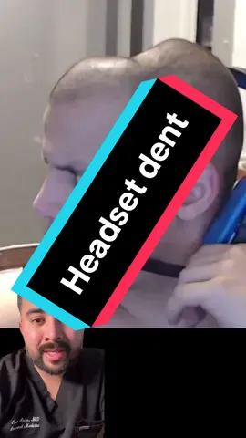 Headsets causing dented heads  