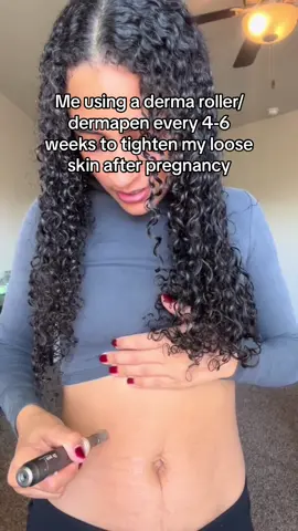 Last February, I realized I wasnt happy with how my stomach was looking after pregnancy. So, I did some research and decided to pair dermarolling with pilates to tighten my skin + core. It’s been a long process (and its still not “perfect”) but I feel so much better in my skin and even bought a bikini for an upcoming trip 👀 #sahm #MomsofTikTok #diyskin #skincare #diygirly #postpartumbody 