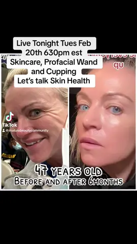Come join me live Tuesday at 630est Feb 20th. Ill be going over how to use the Pro facial wand, Skincare and we can do some cupping together! #facialcupping #cuppingwithmayzo #cupping #profacialwand #skincaretips #47yearsold #beautycontentcreator #maturebeauty #skintalkwithmayzo #skincarewithmayzo #fyp #viralskincare #funlive 