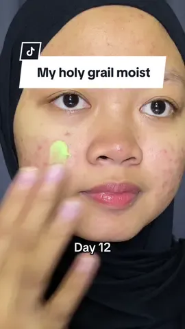 Secinta itu sama moisturizer dorskin 🥹🫶🏻 | #acneproneskin #jerawat #acnejourney #skincare 