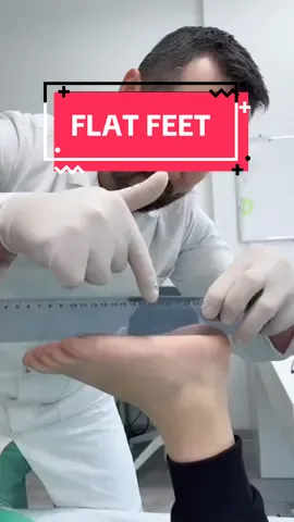 Flat feet check ✅ Is a foot adjustment the correct way to resolve flat feet? ❌ #flatfeet #footadjustments #NYCchiro #LearnOnTikTok #GetAdjustedNow 