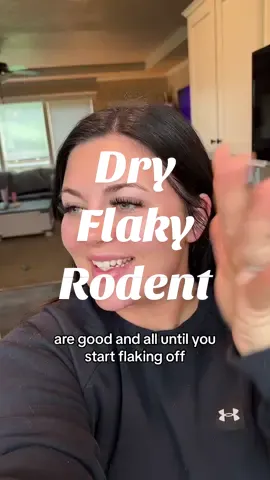 Currently in the dry flaky rodent stage ✌🏼#skin #skincare #treatments #beauty #fyp #fypシ 