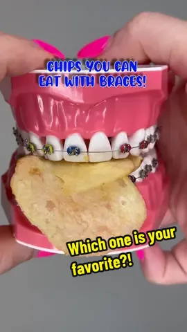 Which one is your favorite? 🦷 #braces #chips #fyp 