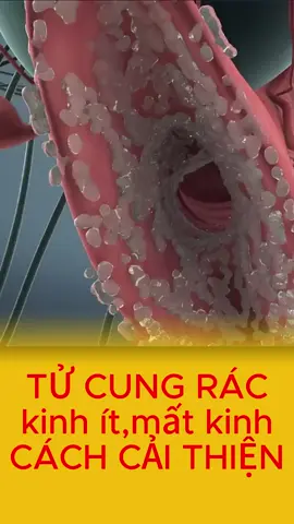 Tử cung đầy rác phải làm sao #xuhuong #thinhhanh #meohay #caythuoc #suckhoesắcđẹp #phunu #suckhoe #tửcung #kinhnguyet #kinhnguyetit #suckhoe #samtonu #samtonu4vi 