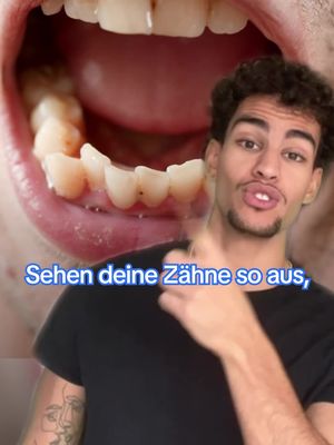 Dein neues Lächeln ab 33€ pro Monat