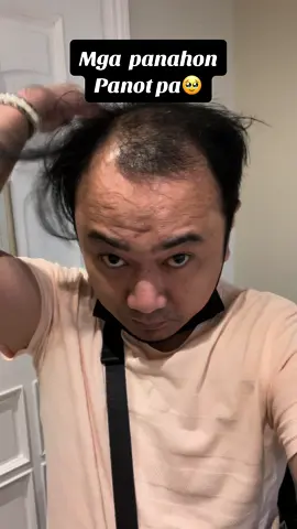 Matagal ko na tong pangarap almost 5 year’s,,, diko magawagawa dahil sa di pa sapat ang budget🥹 at finally ito na sya at nagawa ko an rin sya nakakabalik confidence talaga🥰 #fypシ #foryou #hairtransplant #hairtransplantation #hairtransplantphilippines 