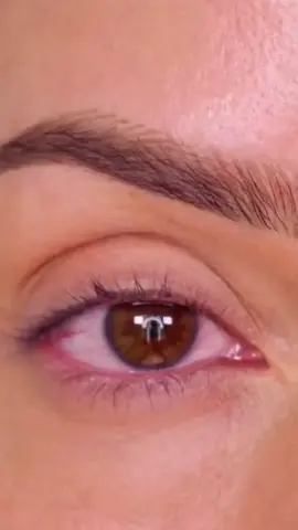 العيون الجافة و مسبباتها #eyewear #fyp #optics #eyes #glasses #dryeyes #عيون 