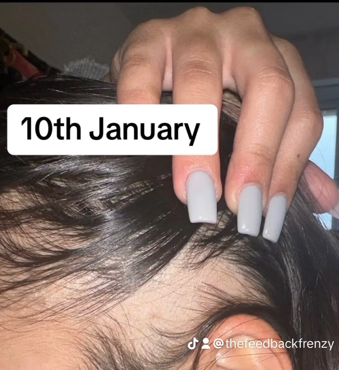 #tiktokers🇦🇪 #dubai #hair #oil #trending #uae #girls #results #boy #men #confidence #grow #smart #handsome #hairtransformation #Love #bestfriend #unitedarabemirates #instagram #gift #VIP #vip #elite #classic #model #influencer #facebook #marketing 