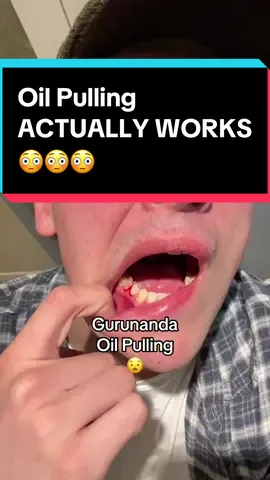 Oil pulling has been so beneficial for my oral health! My teeth are whiter, my breath smells better. Plus it has so many more benefits! #oilpulling #gurunandaoilpulling #oilpullingbenefits #oilpullingforteeth #gurunanda #whitesmile #oralcareroutine #gingivitis 