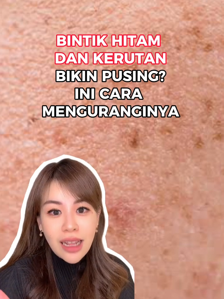 Buat kamu yang ada bintik hitam dan kerutan, cek vt ini untuk tips atasi masalahmu 🥰 #edukasiskincare #edukasidokter #retinol #kerutan #dermaexpress #dexskin