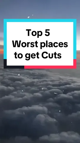 Top 5 worst places to get a cut. Like if you agree, comment if you think other places! #fyp #foryoupage #top5 #top5worst #cuts #trending #foryourpage 