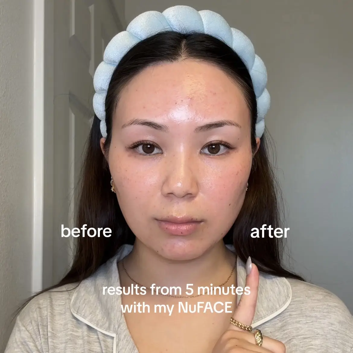 5 minutes is all it takes to get instantly toned, lifted, and contoured ⚡️ Add our 5-Minute Facial-Lift into your morning routine ☀️ #nuface #nufaceresults #nufacebeforeandafter #nufacedevice #microcurrentfacial #microcurrent #microcurrentdevice #nufaceroutine #nufacetrinity #nufaceapp