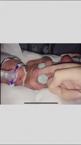 #yacreci #CapCutAmor #CapCutFamília #mifamilia #bebeprematuro #unmilagro #mamade6hijos #family 