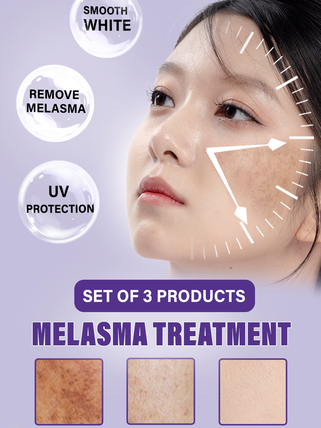 여름이 다가오고 있습니다. 여름처럼 밝고 빛나는 피부를 준비하세요 #jklab #melasma #주근깨