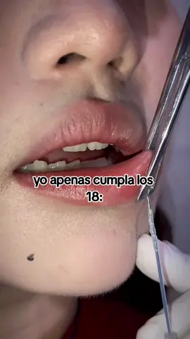 quiero ese piercing.  // #lippiercing #piercing // //@tiktokglobal // #videoviral #texto #yo #fyp #foryou #noflop #viral #parati // lo subo devuelta porque el otro quedó en flop 