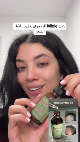 #maroco🇲🇦algeria🇩🇿tunisia🇹🇳 #foryoupage #foryoupageofficiall #الشعب_الصيني_ماله_حل😂😂 #foryoupageofficiall❤️❤️tiktok #الغربة #hairoil #hairoiling #اكسبلورexplore #foryourpagetiktok ##حل_تساقط_الشعر 