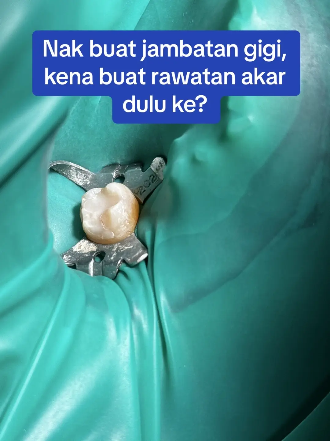 #doktorgigi #doktorgigimalaysia #doktorgigijohor #doktorgigipasirgudang #dentistpasirgudang #dentist #klinikgigi #klinikgigipasirgudang #dentalclinic #dentalclinicpasirgudang #pasirgudangproblem #drqdentistpasirgudang #jbstyle🔥 #jbstylebrader #jbstyle #pasirgudang #pasirgudangjohor #rawatanakargigipasirgudang #jambatangigipasirgudang 