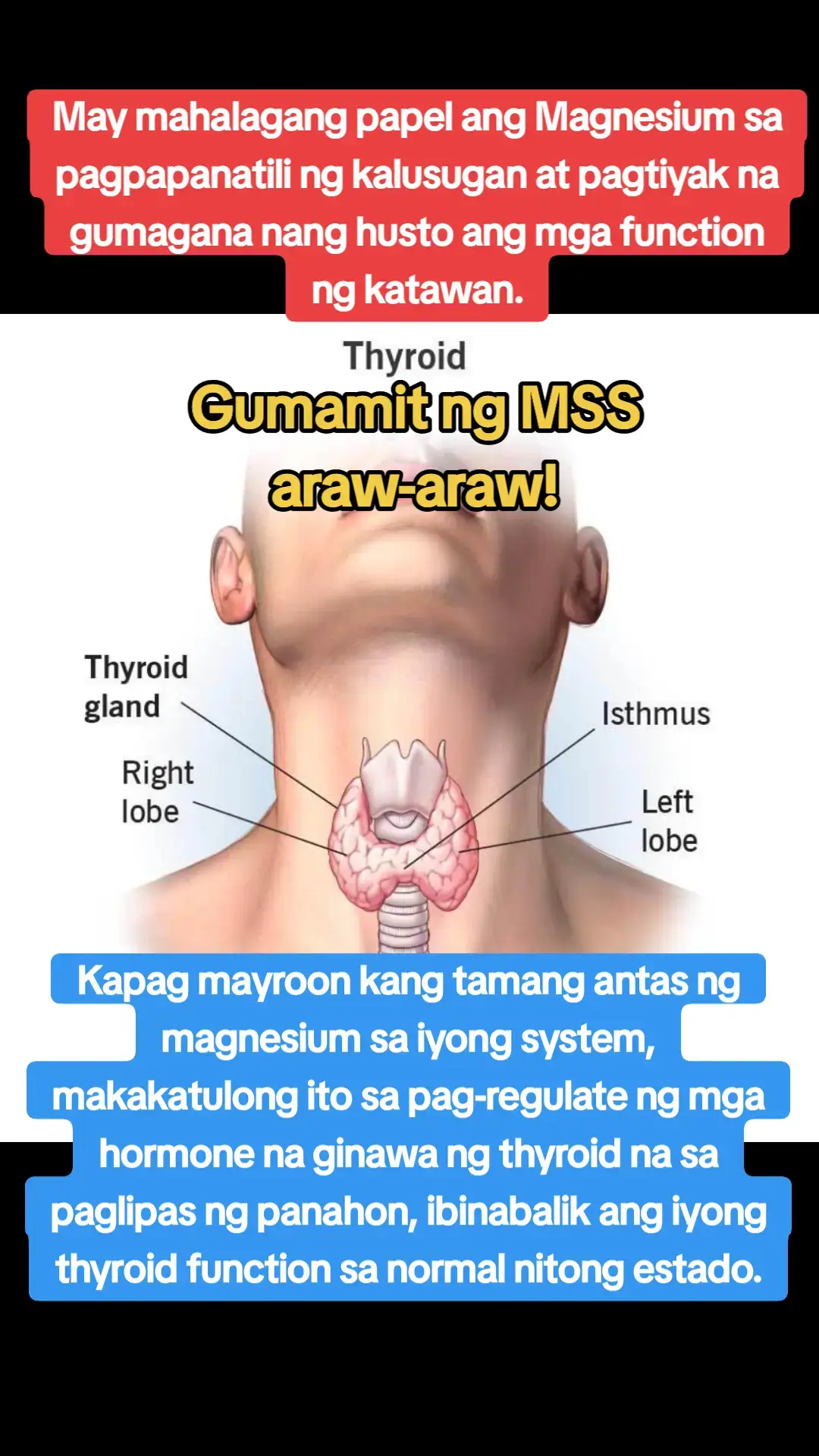 Ano nga ba ang MSS o MAGNESIUM SALT SPRAY? Ito ay pinagsama-samang nga MINERALS,pangunahin ang MAGNESIUM, na inilagay sa isang bote at ipinapahid lang sa BALAT o sa apektadong bahagi,NAPAKALAKI ng kinalaman ng pagkakaroon ng ibat-ibang karamdaman kapag NAWAWALAN ng SAPAT na MINERALS o kaya hindi ito balanse, kaya kapag nabigyan mo ng sapat na minerals ang katawan mo kusang magsisiwalaanbang mga nararamdaman dahil naa-ACTIVATE nito ang NATURAL HEALING MECHANISM,lalo Kong masasabayan ng iba pang mga bitamina lalo ng mayaman sa Bvitamins o Bcomplex,at SAPAT na inom ng tubig,tulog at ehersisyo at makapag paaraw, alisin ang galit sa puso, piliin laging sumaya. Ang kahit anong karamdaman ay maaring GUMALING kapag naibigay mo ang kakailanganin ng iyong katawan. #MSS  #allinone #miraclespray #NATURALnaPANLUNAS #MAGNESIUMsaltSPRAY #naturalnapanlunasadvocate #pisikpisiktanggalangmgasakit #TRANSDERMALmineralSUPPLEMENT#amazing #miraclespray #health #thyroid 