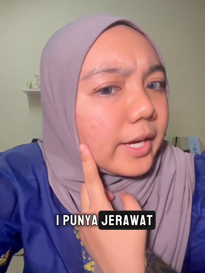 Mencari solusi segera untuk menghilangkan jerawat 🧐 Datanglah ke One Doc untuk mencuba treatment Ultra Picopulse dan capai 