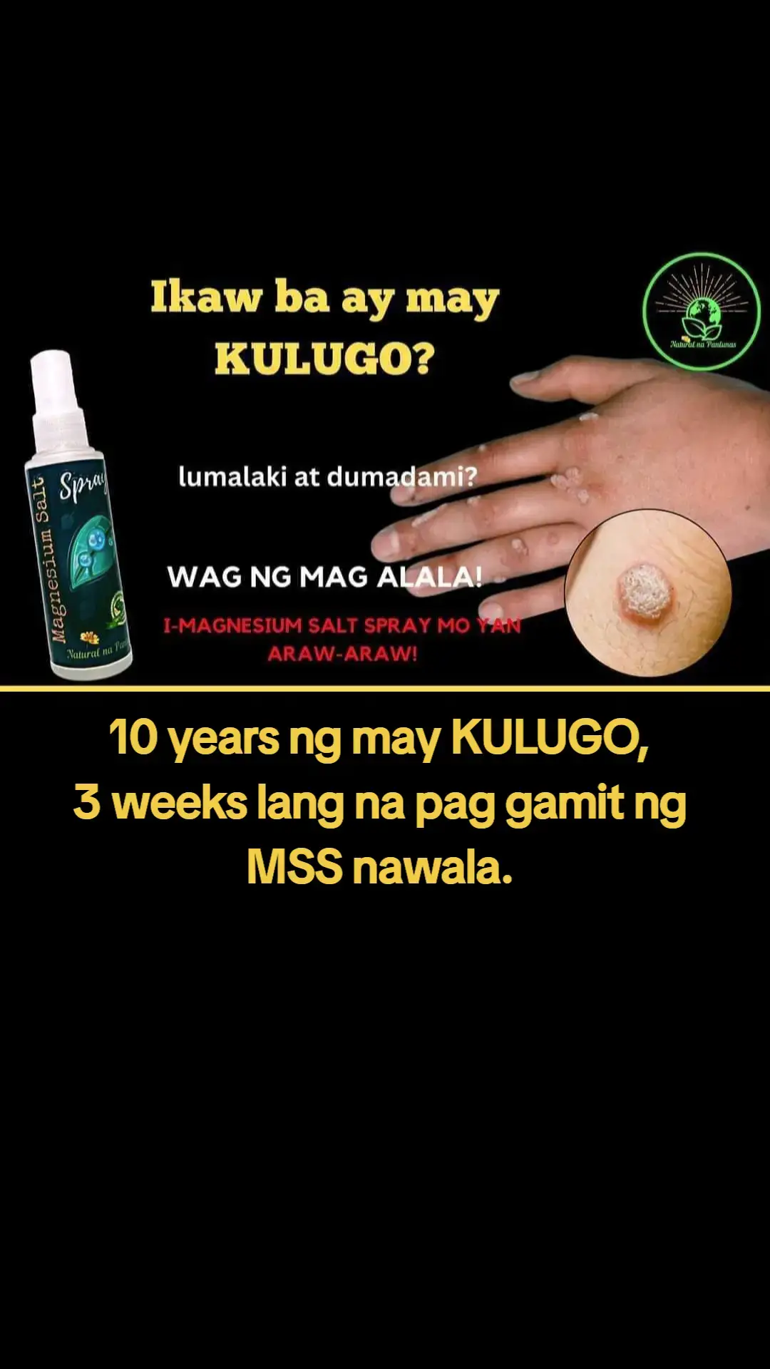 Ano nga ba ang MAGNESIUM SALT SPRAY? Ang MSS minerals ang content nya, pangunahin ang MAGNESIUM. Kaya po tayo nakakaranas ng ibat-ibang karamdaman dahil sa kakulangan ng mga minerals lalo na ang magnesium. Kapag naibigay natin ito araw2x sa katawan,kusa na pong mag-re-repair ang katawan o ma-aactivate na ang natural healing mechanism nito. #MSS #MAGNESIUMsaltSPRAY #NATURALnaPANLUNAS #magnesiumdeficiency #magnesiumbenefits #naturalnapanlunasadvocate #minerals #allinone  #transdermalmineralsupplement #amazing #health#warts #amazing #miraclespray #health 