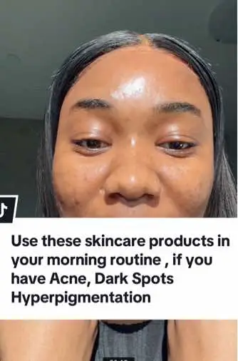 #acnesolutions #darkspottreatment #morningskincareroutine #affordableskincareproducts 