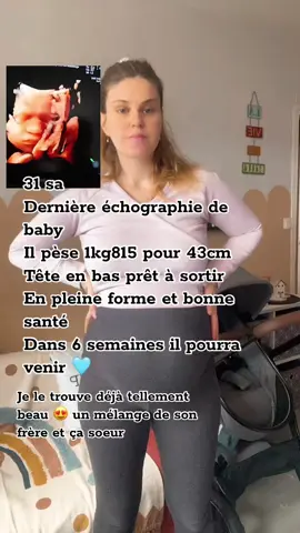 #echographie #pregnant #enceinte #cejour #babylove #bebe #pourtoi #boy #31 #zelio #photo  trop hate de te rencontrer mon amour 🩵❤️