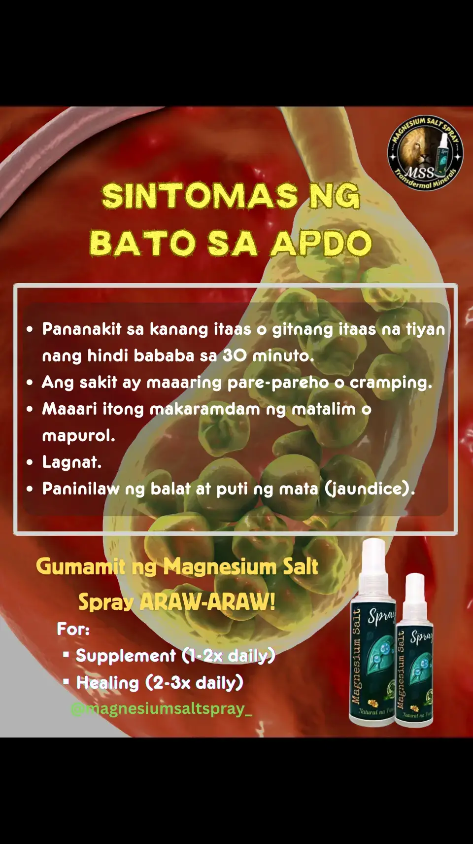 Ano nga ba ang MAGNESIUM SALT SPRAY? Ang MSS minerals ang content nya, pangunahin ang MAGNESIUM. Kaya po tayo nakakaranas ng ibat-ibang karamdaman dahil sa kakulangan ng mga minerals lalo na ang magnesium. Kapag naibigay natin ito araw2x sa katawan,kusa na pong mag-re-repair ang katawan o ma-aactivate na ang natural healing mechanism nito. #MSS #MAGNESIUMsaltSPRAY #NATURALnaPANLUNAS #magnesiumdeficiency #magnesiumbenefits #naturalnapanlunasadvocate #minerals #allinone  #transdermalmineralsupplement #amazing #health #miraclespray  #gall 