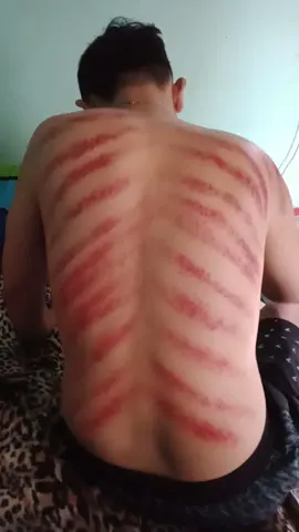Sehat yu Gio....sehat sehat sehat... Dari sini kita bisa ambil hikmah nya yah... Thanks buat Abang gw yg udah mau ngerokin Adek nya yg 4 hari sakit. sekarang Fokus yuk buat cari biaya untuk kontrol 🤲🤲🤲