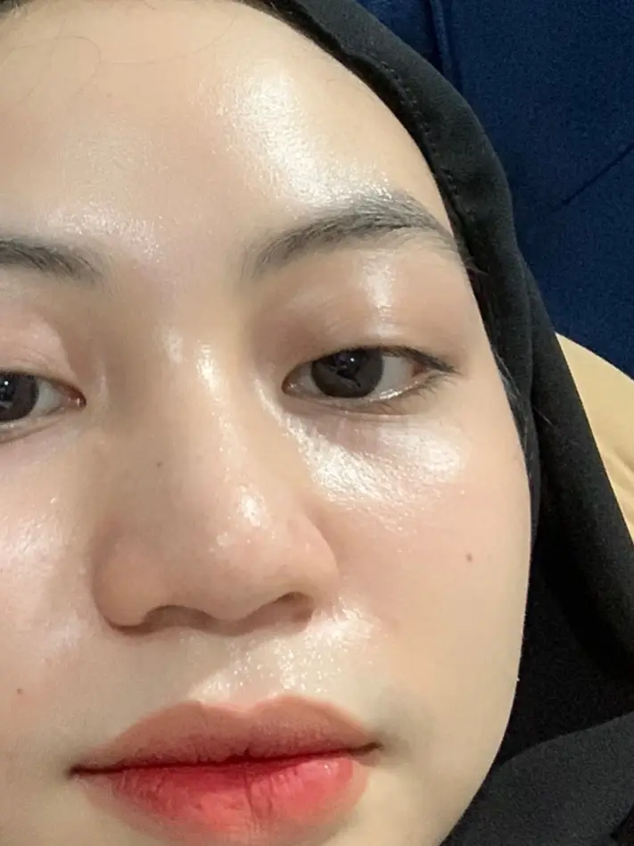 Finally raya tahun ni dpt merasa skin mcm org lain 🫶🏼🫶🏼 #fyp #fypage 