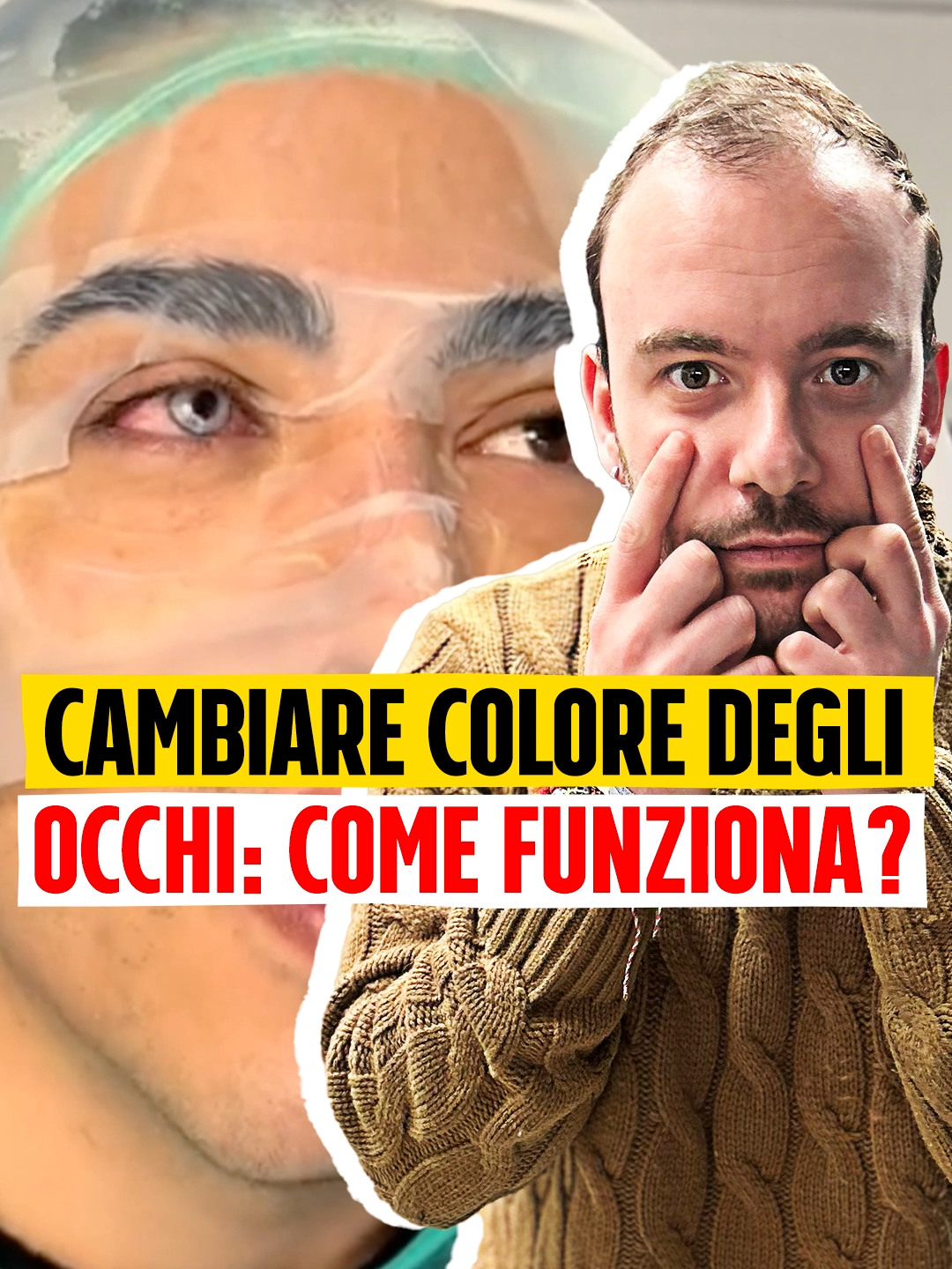 Questo tiktoker italiano di recente si è fatto cambiare il colore degli occhi, e no non si è messo delle lenti colorate ma ha proprio cambiato il colore degli occhi con un’operazione chirurgica, si chiama cheratopigmentazione, passando da questo colore a … questo. Ma come si può cambiare il colore degli occhi?  Ce lo spiega Claudio Valletta