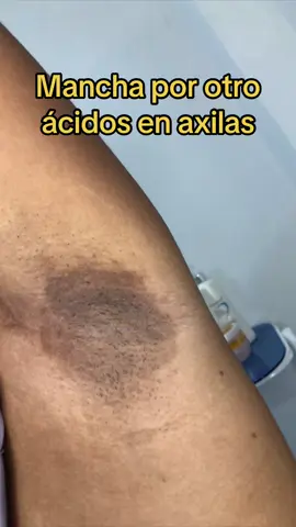 Irritacion en axilas #elijak #elix #elixdespigmentante 