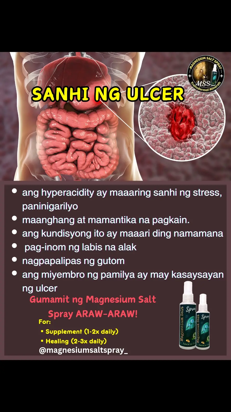 Ano nga ba ang MAGNESIUM SALT SPRAY? Ang MSS minerals ang content nya, pangunahin ang MAGNESIUM. Kaya po tayo nakakaranas ng ibat-ibang karamdaman dahil sa kakulangan ng mga minerals lalo na ang magnesium. Kapag naibigay natin ito araw2x sa katawan,kusa na pong mag-re-repair ang katawan o ma-aactivate na ang natural healing mechanism nito. #MSS #MAGNESIUMsaltSPRAY #NATURALnaPANLUNAS #magnesiumdeficiency #magnesiumbenefits #naturalnapanlunasadvocate #minerals #allinone  #transdermalmineralsupplement #amazing #health #miraclespray #ulcer