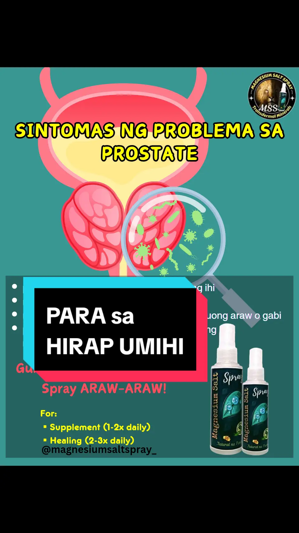 Ano nga ba ang MSS o MA#GNESIUM SALT SPRAY? Ito ay pinagsama-samang nga MINERALS,pangunahin ang MAGNESIUM, na inilagay sa isang bote at ipinapahid lang sa BALAT o sa apektadong bahagi,NAPAKALAKI ng kinalaman ng pagkakaroon ng ibat-ibang karamdaman kapag NAWAWALAN ng SAPAT na MINERALS o kaya hindi ito balanse, kaya kapag nabigyan mo ng sapat na minerals ang katawan mo kusang magsisiwalaanbang mga nararamdaman dahil naa-ACTIVATE nito ang NATURAL HEALING MECHANISM,lalo Kong masasabayan ng iba pang mga bitamina lalo ng mayaman sa Bvitamins o Bcomplex,at SAPAT na inom ng tubig,tulog at ehersisyo at makapag paaraw, alisin ang galit sa puso, piliin laging sumaya. Ang kahit anong karamdaman ay maaring GUMALING kapag naibigay mo ang kakailanganin ng iyong katawan. #MSS  #allinone #miraclespray #NATURALnaPANLUNAS #MAGNESIUMsaltSPRAY #naturalnapanlunasadvocate #pisikpisiktanggalangmgasakit #TRANSDERMALmineralSUPPLEMENT