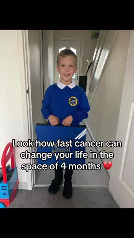 No child should ever have to suffer! And no mother should ever have to see there baby change in so many heartbreaking ways 💔 cancer didnt just take my son.. it took a brother, a grandson, a cousin, a friend.. it took a 6 year old child, robber his childhood and it destroyed so many hearts! Forever heartbroken 💔#jaydensarmy💚 #childhoodcancer #sharehisstory #fightforthem #dipg #nochildshouldsuffer #cancer #forever6 #myreason #imissyou #guardianangel #gonetoosoon #rip #fyp #fypシ゚viral #viral #keepsupporting #share #heartbroken #foreveryoung #raiseawareness 
