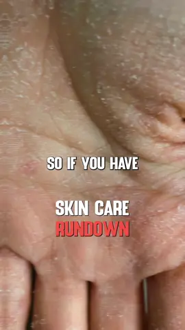 Skin Care Rundown #biohacking #health #skin  