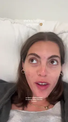 Replying to @luliratti comedic relief is good for the soul 🥹💞🥲 #drylips #accutane #accutanecheck #chappedlips #lipgloss #chapstick #newme #comedy #acnecommunity #comedicrelief 