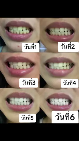 🦷🪥 #ยาสีฟันทิสมา #ขาวเเบบไม่ต้องฟอก #ฟันขาวปลอดภัย #งบหลักร้อย #พันธมิตรแบบชําระเงิน 