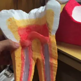 Protótipo do segundo molar inferior, esculpido e modelado em isopor e resina  com a caracterização externa e interna da câmara pulpar, duas raizes e os três condutos radiculares.  #uninove #dente #odontologia #saude #autaestima #felicidade #superacao #alegria #vida #dentistica #progresso #anatomia #escultura #esculturadental #esculturaemisopor #endodontia #seminario #prototipo #obturacao 