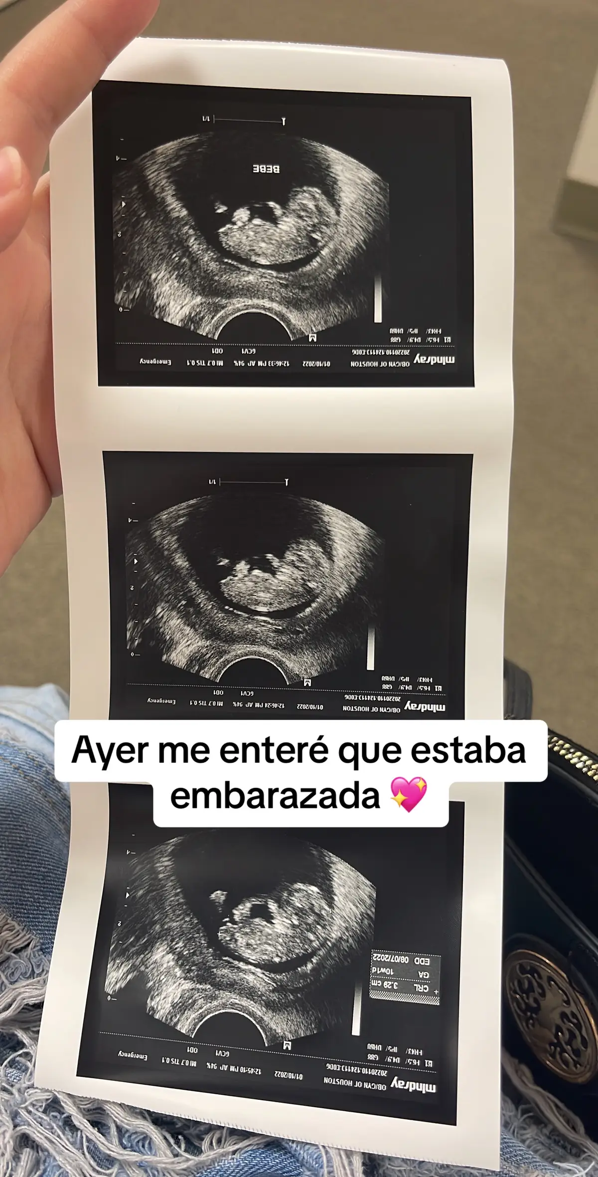 Parece que apenas ayer me entere que estaba embarazada y mi bebe ya nacio y tiene un año y medio 😱😨                                                                                        #pyfツ #baby #parati #mamaprimeriza #viral #trending #babylove #viralvideo 