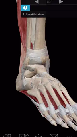 Ruptura Ligamentar do Tornozelo!!! A animação demonstra a ruptura parcial do Ligamento Talofibular anterior, um componente muito importante do grupamento lateral dos ligamentos da articulação do tornozelo!!! Esta região (a lateral) do tornozelo é menos protegida e mais vulnerável a processos de entorse da articulação do tornozelo!! Seus ligamentos e tendões musculares são mais frágeis que na região medial da articulação!! Um ponto importante é a posição de flexão plantar (ficar na ponta dos pés). Esta posição predispõe a uma maior instabilidade articular, em especial, por conta da anteriorização do osso Tálus. Isso ocorre com.muita frequência em mulheres que fazem o uso de sapatos e sandálias de salto!!! Gostou? Então, segue o @anatocast.anatomia , ok? Animação: visível body #anatomia #anatomy #anatocast #anatomiaarticular #anatomiafuncional #anatomiamotora #articulacaon #tornozelo #ligamentos #entorse #luxacao #osteopatia #ortopedia #traumatologia #fisio #fisioterapia #med #medicina #terapiaocupacional #propriocepcao #terapiamanual #quiropraxia #professordeanatomia #estudantedeanatomia #biologia #edfisica #educacaofisica #enfermagem #rupturaligamentar #ruptura