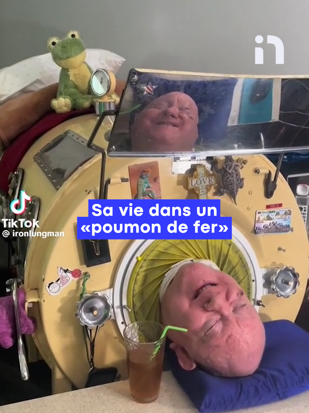 Après avoir passé plus de sept décennies dans une capsule de fer, l'Américain Paul Alexander ou Polio Paul (@ironlungman) s'est éteint lundi à l'âge de 78 ans. Le Texan, avocat, auteur et globe-trotteur s'est retrouvé dans un poumon de fer après avoir attrapé la polio en 1952. #poliopaul #paulalexander #noovoinfo #ironlung