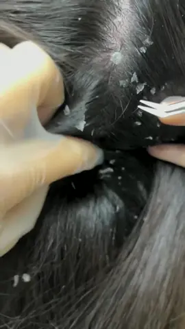 Satisfying Hair Cleaning #fyp #viralvideo #decompression #cleaninghacks 