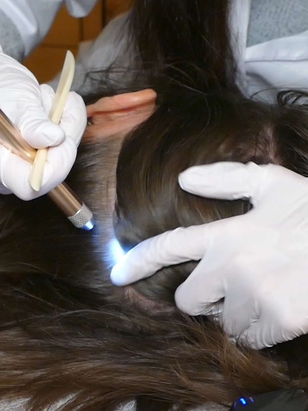 ASMR 3 MINUTES of Doctor SCALP Skin EXAM with Detailed Sectioning (Real Person) #asmr #asmrsounds #asmrvideo #scalpcheck #asmrtiktoks #medicalroleplay