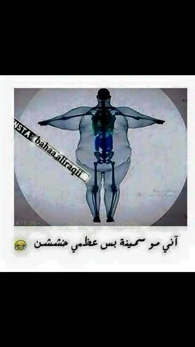 #السمنة #السمنة_المفرطة #😅🤣🤣 #🤣😅😂🙃 #ههههههههههههههههههههههههههههههههههههههه #الاتموت_ضحك😂😂 #الصفحة_ترحب_بالعقول_الراقية✍️📚🖤 #الشعب_الصيني_ماله_حل😂😂 #الشعب_الصيني_ماله_حل😂✌️ 