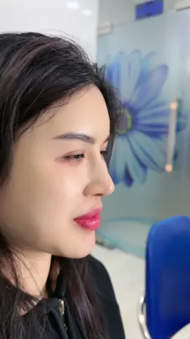 Mũi 6 tháng. Nhiều ngừoi khen nhưng 1 vài ngừoi nói hơi cao, xin ý kiến của mn nhé#bsgiangbvvietduc #noisoibsgiang #xuhuong #nangmui 