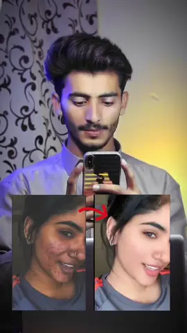 Face Whitening & Smoothing Video editing in Capcut #fyp #viral #capcut #videoediting #tutorial #facesmoothing #facewhitening #foryoupage #LearnOnTikTok 